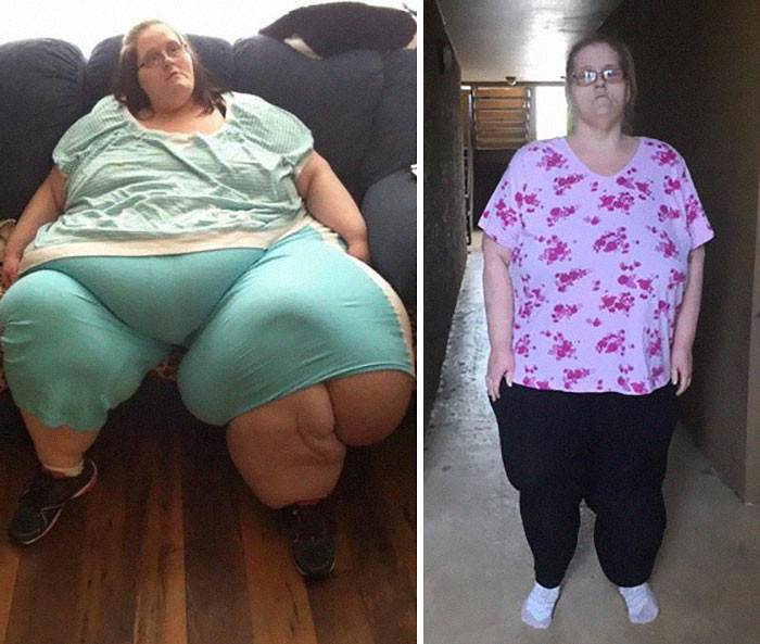 Amazing Before And After Weight Loss Photos From Women Who Were Morbidly Obese 