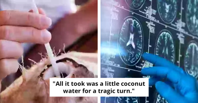 Fatal Coconut Drink Leads to Man's Sudden Brain Injury and Death
