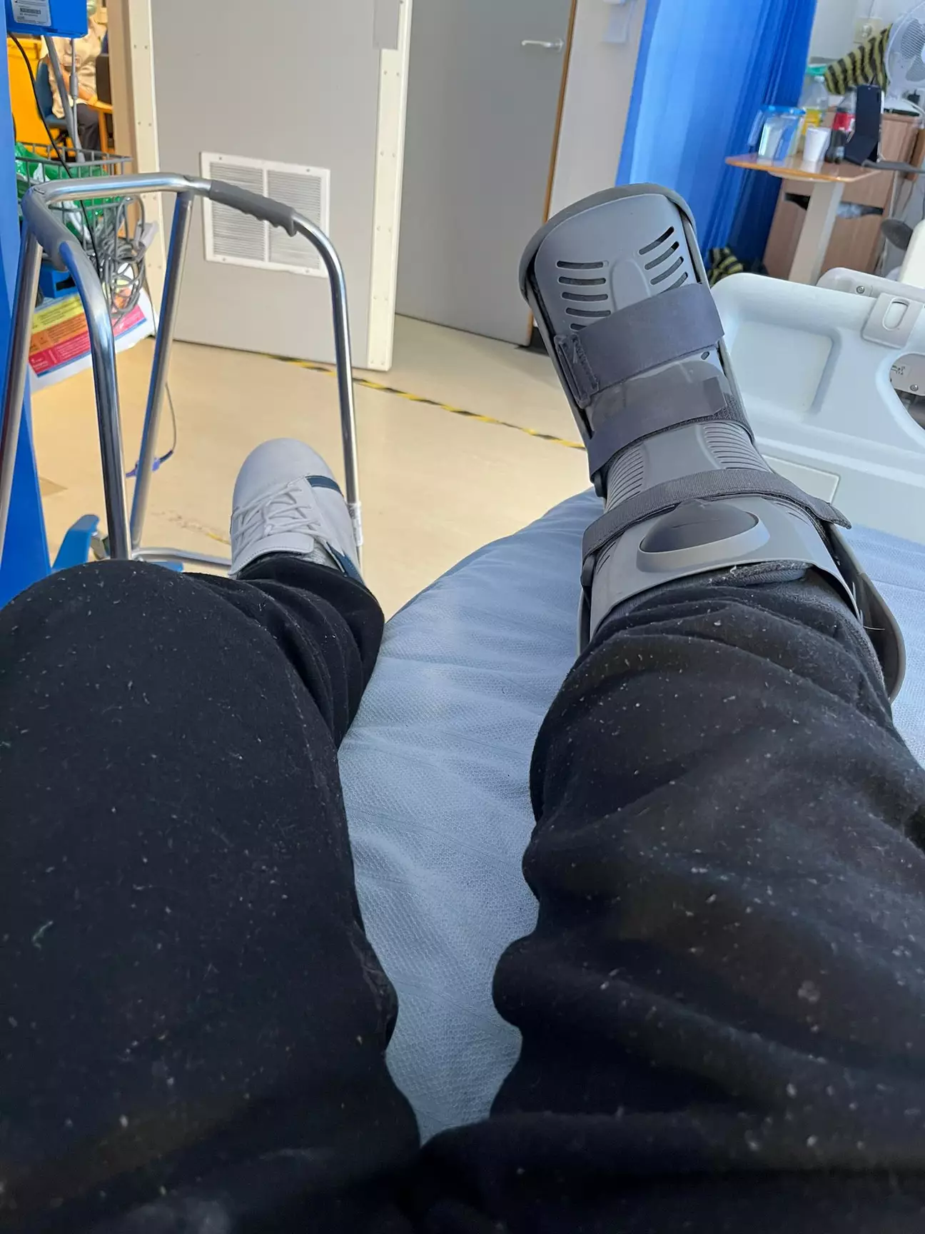 While he was in hospital, doctors found two blocked arteries in addition to his fractured toe, potentially saving his leg from amputation.