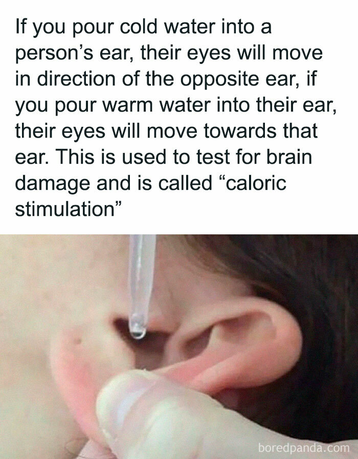 5. The caloric stimulation