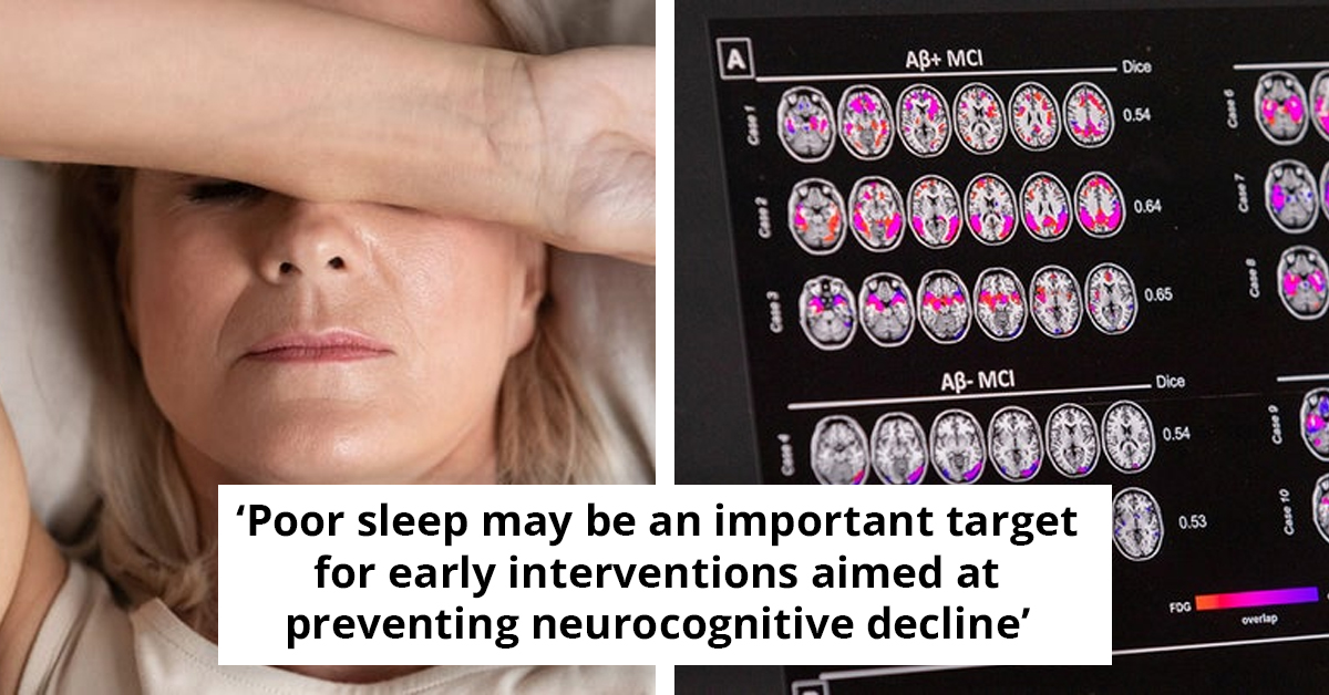Study Finds That Poor Sleep Could Affect The Brain In A New Surprising Way