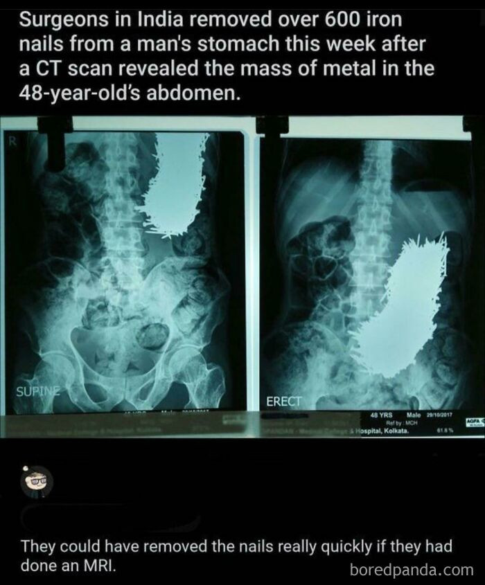 10. Cursed MRI