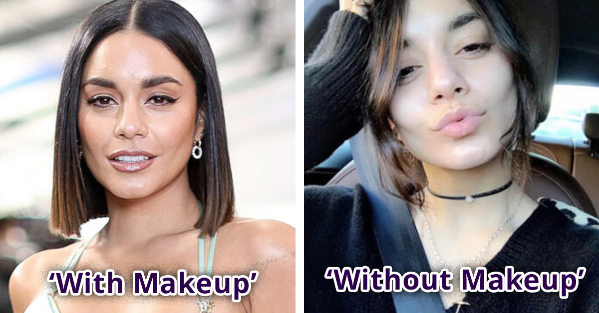 20 Bare-Faced Celebrities Doing Their Part To Show The World We Don't Need Makeup To Look Beautiful