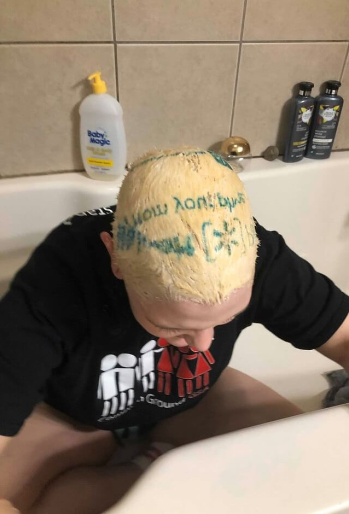 10. This girl was bleaching her hair and put a plastic bag from Walmart over it to help the heat stay in and it printed the ink onto her hair