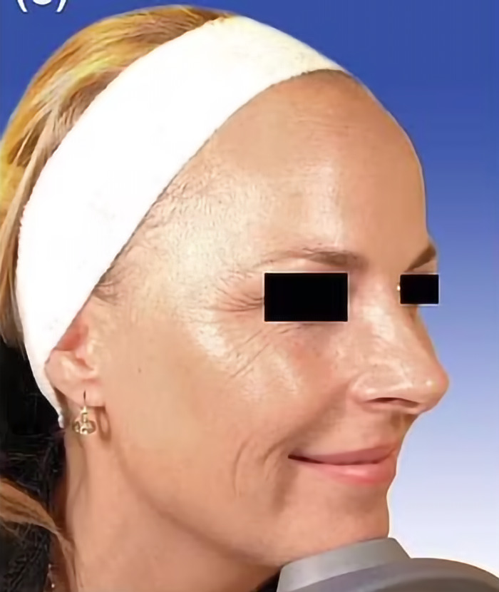 Wrinkles or not, beauty standards will always spark a war of opinions.