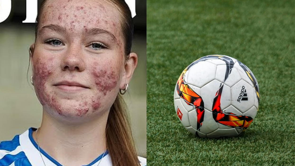 A 16-year-old football player who was recently targeted with cruel online comments about her skin has delivered the perfect response—not with words, but with her talent on the pitch.