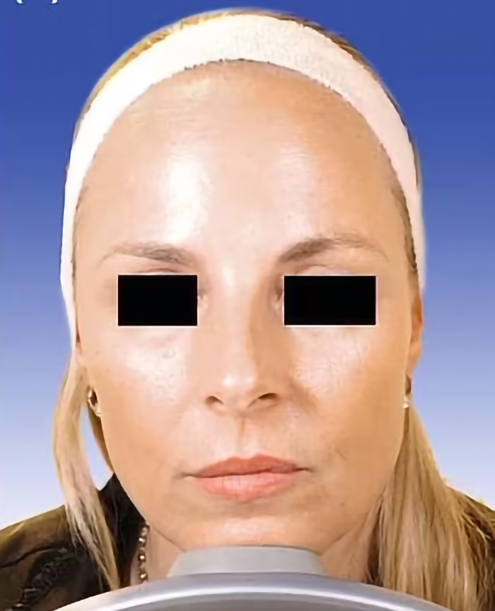 This close-up comparison fuels the debate over whether succumbing to cosmetic beauty trends truly beats natural aging